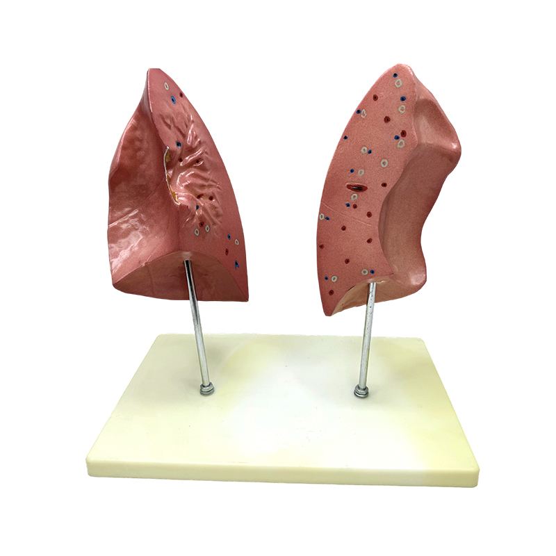 Teaching biological model left and right lungs model human viscera lung anatomical model